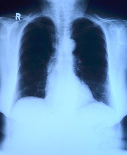 Czym jest promieniowanie rentgenowskie i jak umożliwia diagnostykę medyczną